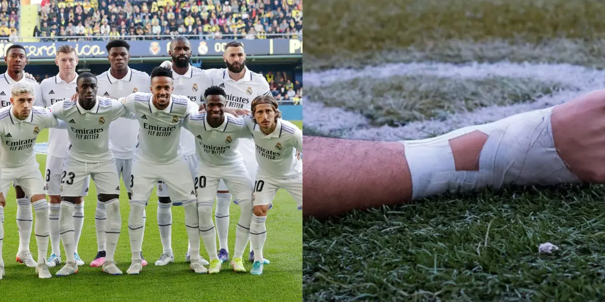 Carlo Ancelotti will have to look for alternatives to replace him.